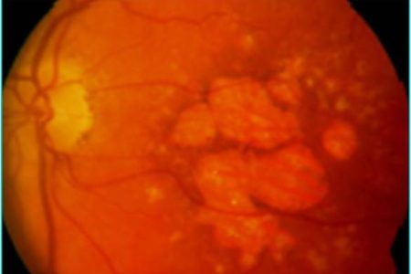 Retina: una finestra sulla salute