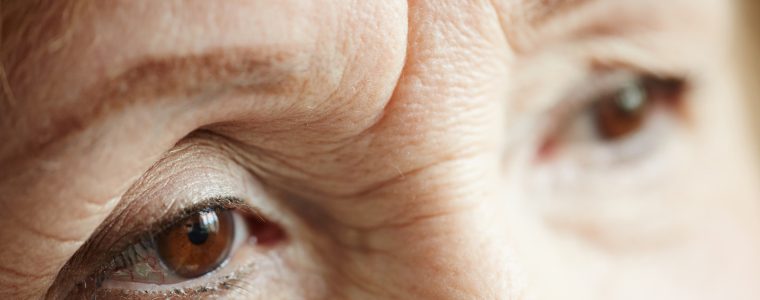 Glaucoma e farmaci a rilascio prolungato